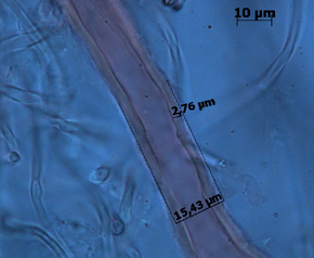 Gefäßhyphe 15,43 ym mit sehr dicken Wänden (2,76 µm). Foto: Rüpke
