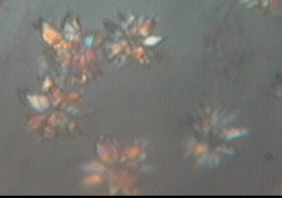 Bis 15 my große Sternzystiden, Erkennungsmerkmal des Zweifarbigen Harz-Rindenpilz, Resinicium bicolor, Foto Rüpke