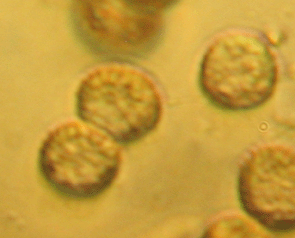 Schleimpilzsporen 8 µm