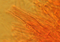 Gleicht dem Echten Hausschwamm, eine Gefäßhype von Leucogyrophana pulverulenta. Unterschied sind z.B. die fehlenden Faserhyphen.