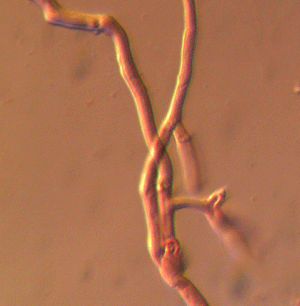 Lungenseitling, Pleurotus pulmonarius, Grundhyphen dünnwandig, hyalin, 4-6xm. regelmäßig septiert und mit kleinen Schnallen. 