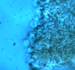 Lungenseitling, Pleurotus pulmonarius, Zystiden mit kugelförmigen Auswüchsen